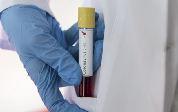 Foto - Virüsün yayılma hızını ne etkiliyor? Malezya, Singapur ve Hong Kong'da vaka sayısının düşük olmasının nedeni