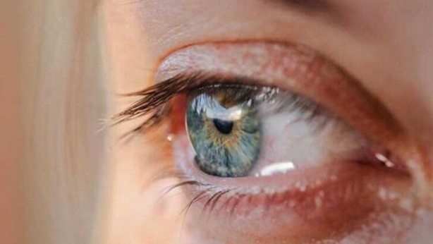 Foto - Vitamin eksikliğinin 8 belirtisi