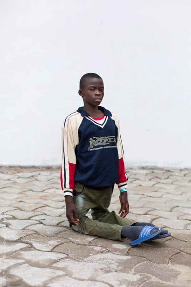 Foto - Vücudu ikiye katlanıyordu! Şimdi yürüyebiliyor