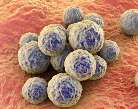 Foto - Vücudu toksinlerden arındıran 5 yiyecek