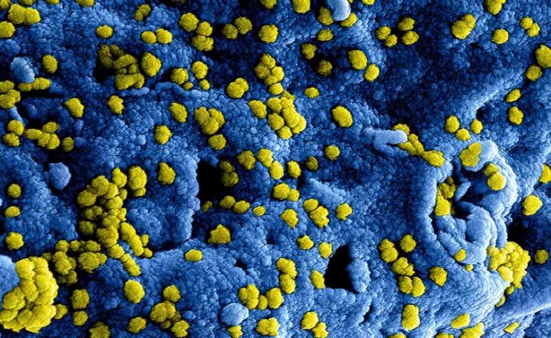 Foto - Vücudu toksinlerden arındıran 5 yiyecek