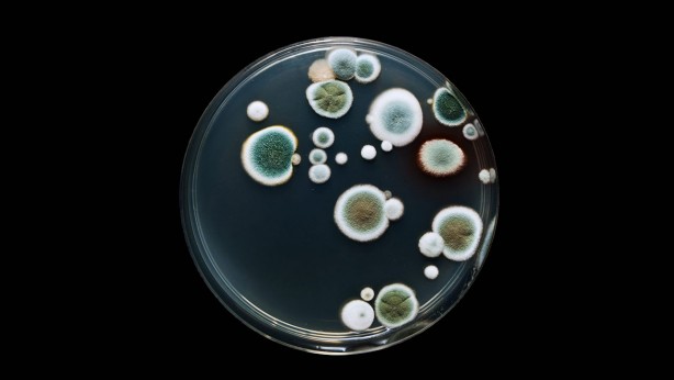 Foto - Vücudu toksinlerden arındıran 5 yiyecek