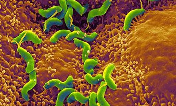 Foto - Vücudumuzda büyük tehlike! Farkınızda olmadan senelerce yaşıyor... İşte o helikobakter pilori bakterileri...