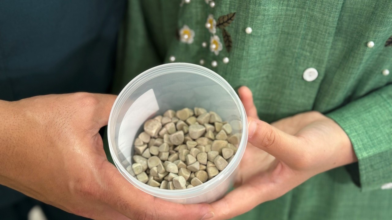 Foto - Vücudundan 287 tane taş çıkarıldı, doktorlar bile şaştı kaldı