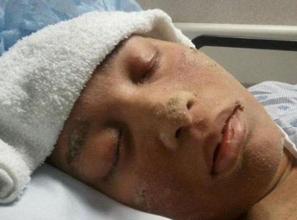 Foto - Vücudunun her yerinden tırnak çıkıyor!