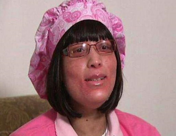 Foto - Vücudunun her yerinden tırnak çıkıyor!