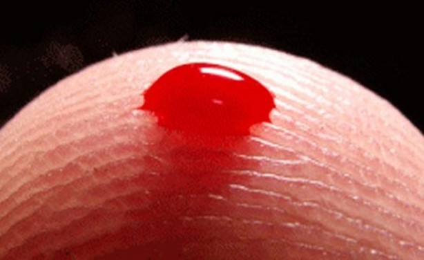 Foto - Vücudunuz hastalığınızı ele veriyor