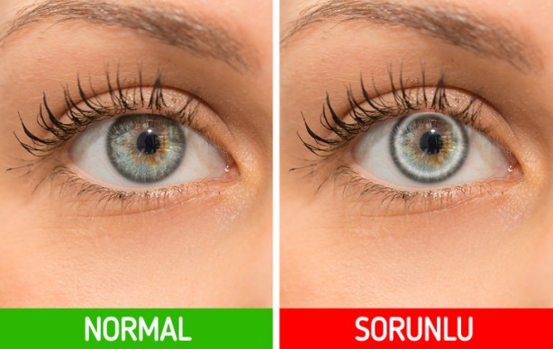 Foto - Vücudunuzun size ters giden bir şeyler olduğunu anlatmasının 9 yolu