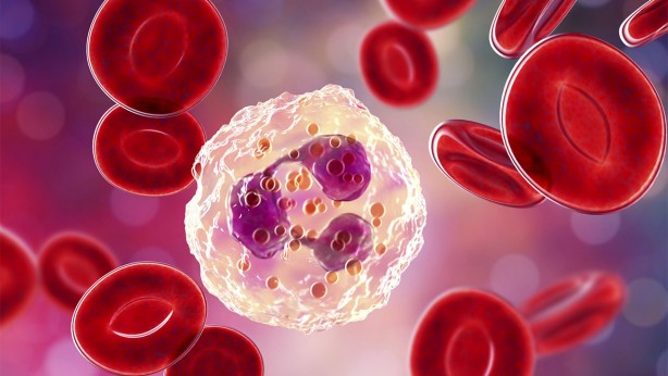 Foto - Vücutta iltihaba neden oluyor! Mutfağınıza sokmayın