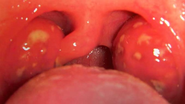 Vücutta iltihaba neden oluyor! Mutfağınıza sokmayın