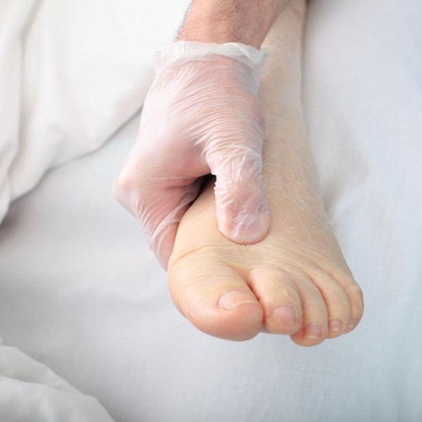 Foto - Vücuttaki ödeme savaş açan gıdalar