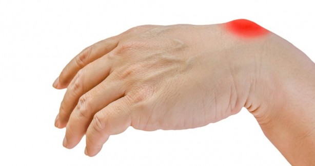 Foto - Vücuttaki ödeme savaş açan gıdalar