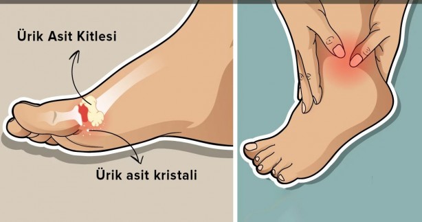 Vücuttaki ürik asidi düşürebilecek 8 besin şoke etti! Görülmemiş oranda en hızlı böyle önlüyor, deva oluyor 