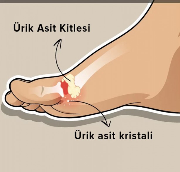 Foto - Vücuttaki ürik asidi düşürebilecek 8 besin şoke etti! Görülmemiş oranda en hızlı böyle önlüyor, deva oluyor 