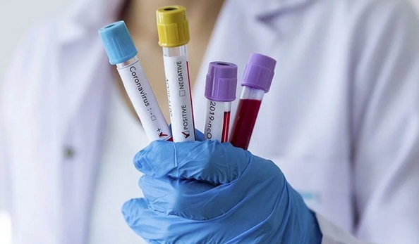 Foto - X Hastalığı: Vücudu en hızlı zehirleyen salgın tehdidi dengeleri altüst edecek! Dünya liderlerinin bile gündeminde