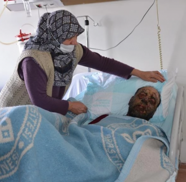 Foto - Yağmur ormanlarındaki hastalık Erzurum'da görüldü!