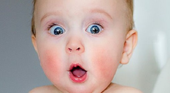 Foto - Yalancı şaşılık nedir? 