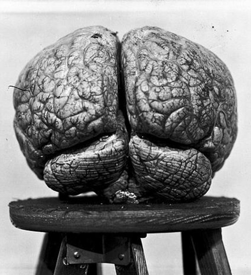 Foto - Üniversite bodrumunda kan donduran fotoğraflar...