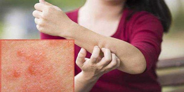 Foto - Yanınızda bu hareketi yapan varsa, arkanıza bile bakmadan hemen topuklayın! 8 hafta boyunca hayatınız kâbusa dönebilir