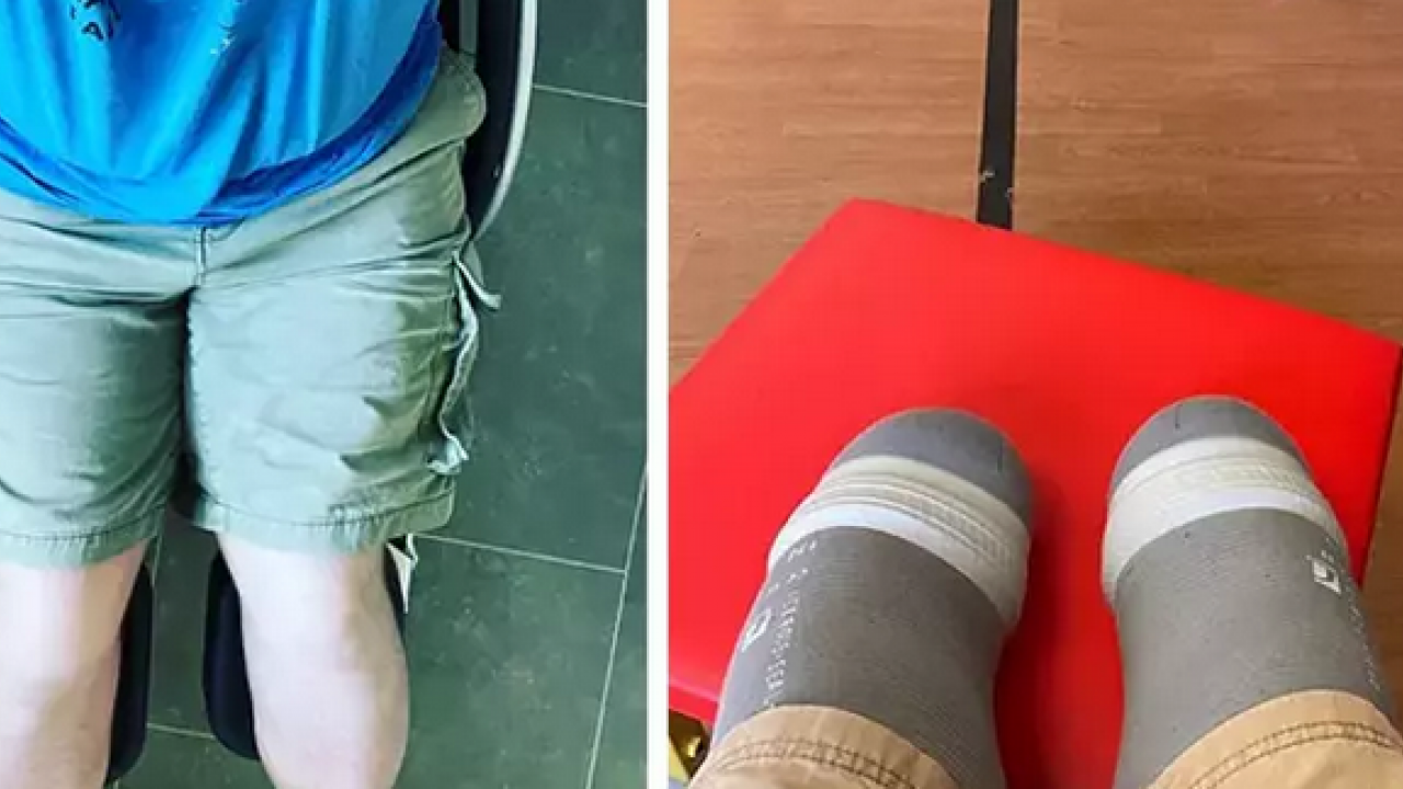 Foto - Diz altı ampütasyonu! Cerrahın buzla ölümcül oyunu ve 26 milyonluk vurgun... 'Bacaklarımı dondurdum'