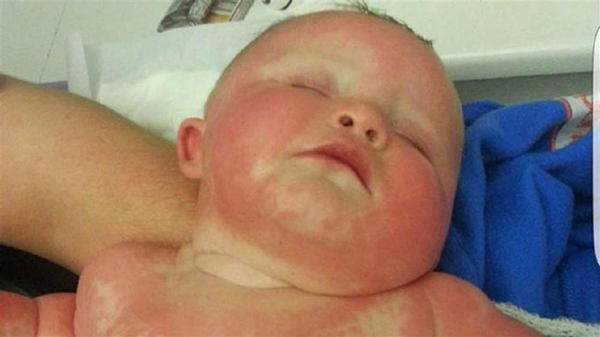 Foto - Yanlış teşhis az kalsın öldürüyordu!