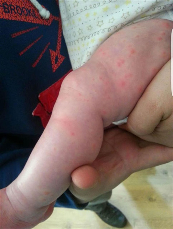 Foto - Yanlış teşhis az kalsın öldürüyordu!