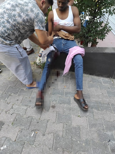 Foto - "Yanlış zil" dehşeti! Zili karıştırdı az daha canından oluyordu