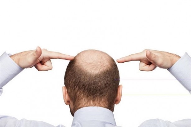 Foto - Yanlışlıkla icat edilen şeyler