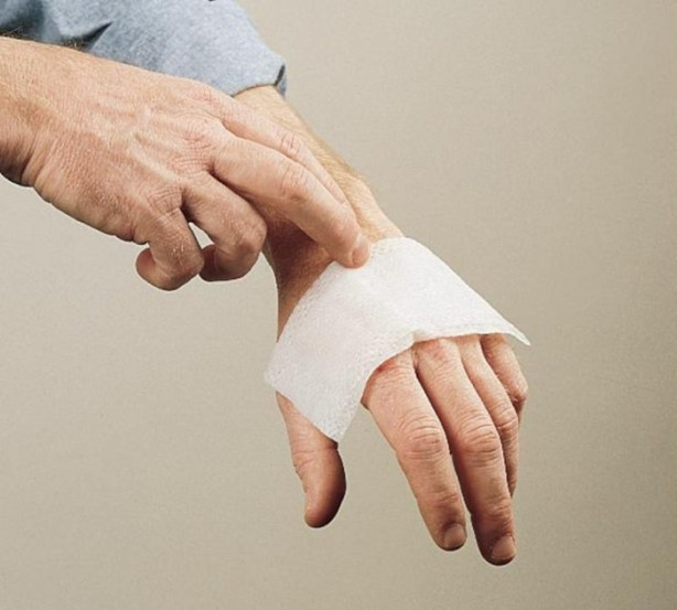 Foto - Yanmış derinize soğan suyu sıkarsanız...