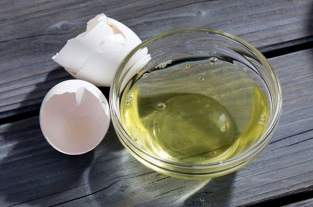 Foto - Yanmış derinize soğan suyu sıkarsanız...