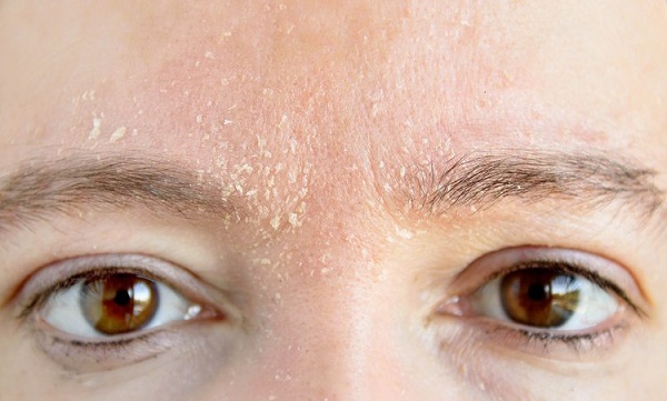 Yapanlar pişman olmaz! Sağlıklı bir cilt için 7 altın öneri!