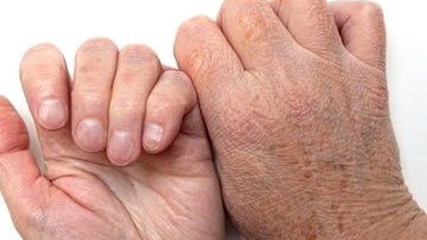 Foto - Yapanlar pişman olmaz! Sağlıklı bir cilt için 7 altın öneri!