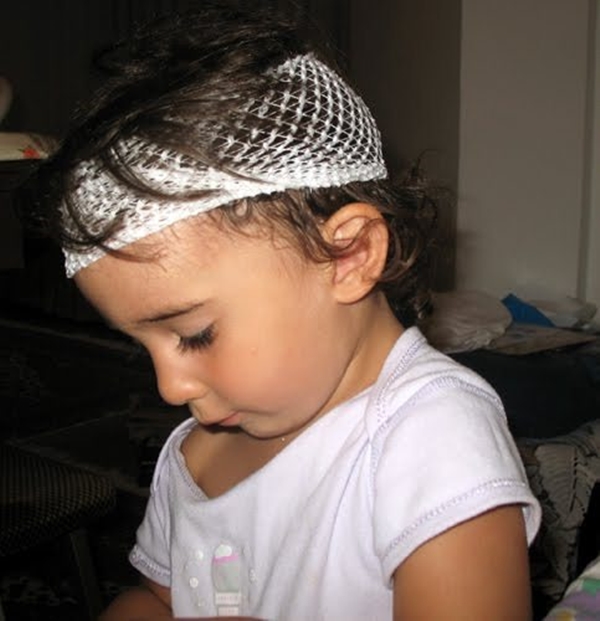 Foto - Yaraları iyileştirirken bu hataları yapmayın!