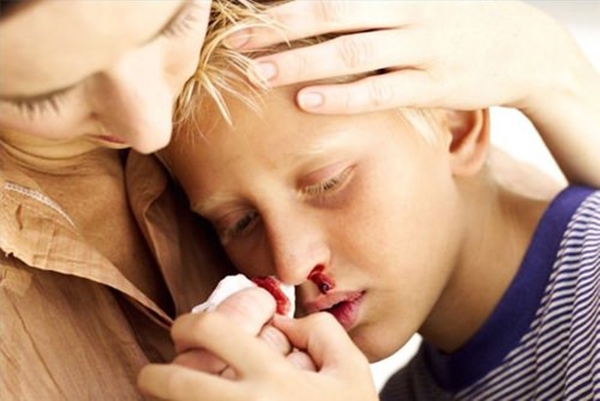 Foto - Yaraları iyileştirirken bu hataları yapmayın!