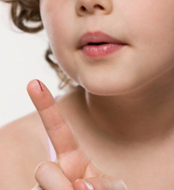  Yaraları iyileştirirken bu hataları yapmayın!