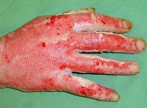 Foto - Yararları saymakla bitmiyor