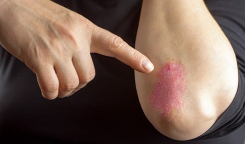 Foto - Yararları saymakla bitmiyor