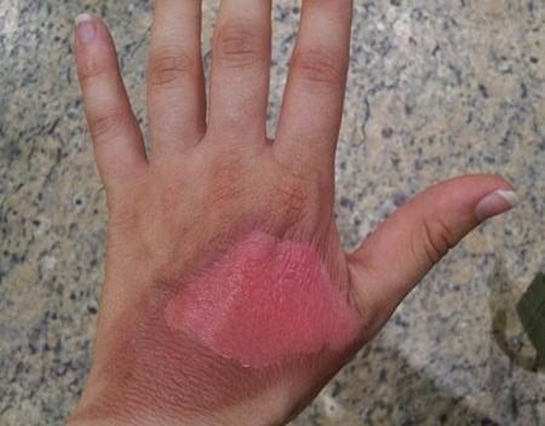 Foto - Yararları saymakla bitmiyor