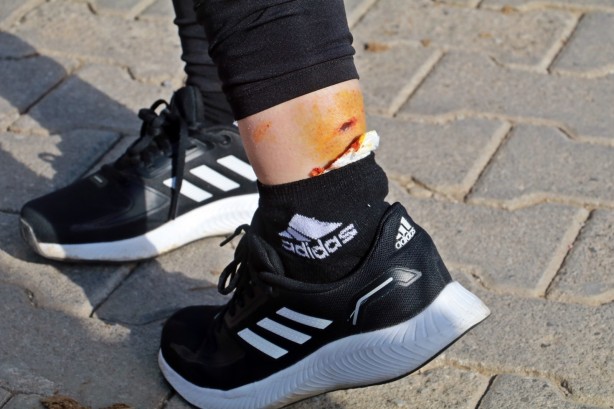 Foto - Yasaklı köpek, genç kadın ve köpeğine dehşeti yaşattı! İşte o anlar...