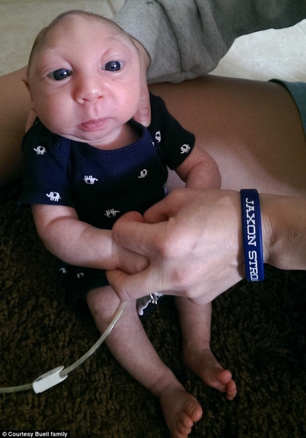 Foto - Yaşamaz denilen o bebek 1 yaşında