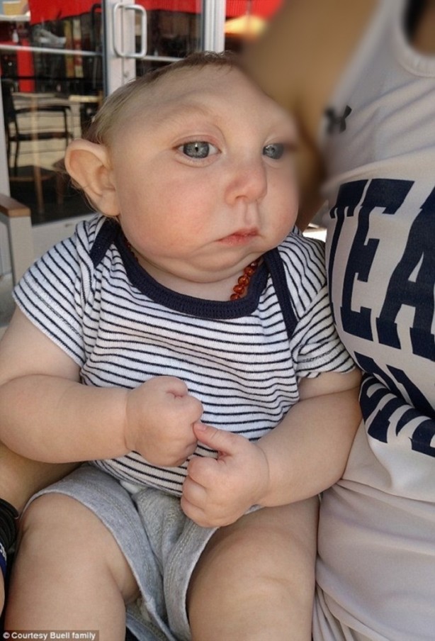 Foto - Yaşamaz denilen o bebek 1 yaşında