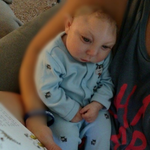 Yaşamaz denilen o bebek 1 yaşında