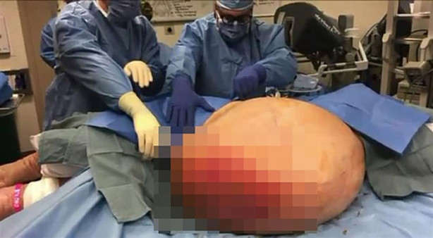 Foto - Yaşlı kadın doktorları şok etti!