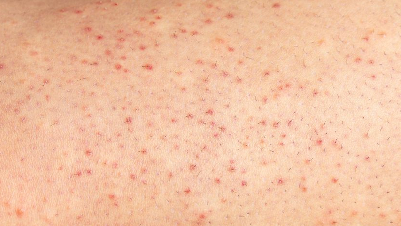 Foto - Yastığın altına bir diş sarımsak koymak çok iyi geliyor! Sebebi ortaya çıktı, yapan herkesi şaşırttı! Siper oluyor, test edin