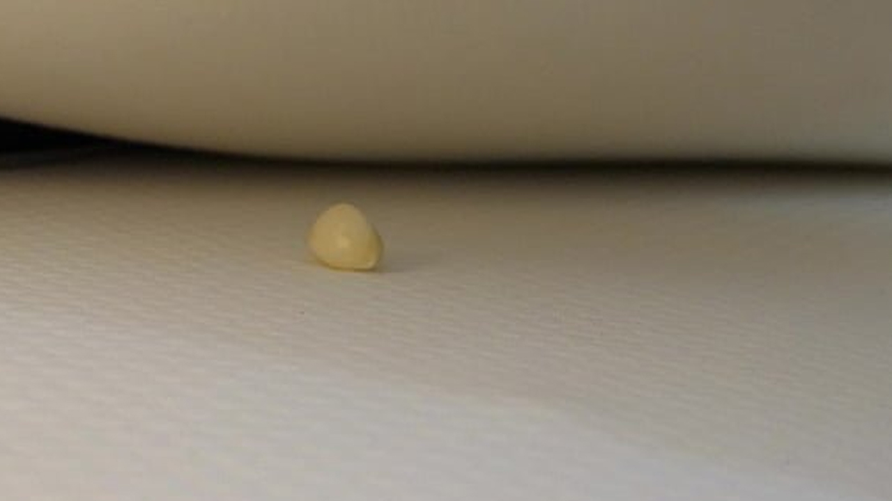 Foto - Yastığın altına bir diş sarımsak koymak çok iyi geliyor! Sebebi ortaya çıktı, yapan herkesi şaşırttı! Siper oluyor, test edin