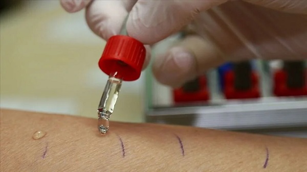 Yaz aylarında poşet poşet tüketiliyor | Dikkat o meyve kabusunuz olabilir