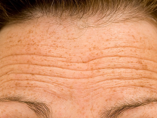 Foto - Yaz mevsiminde bunlara dikkat edin! İşte ışıl ışıl cildin sırrı