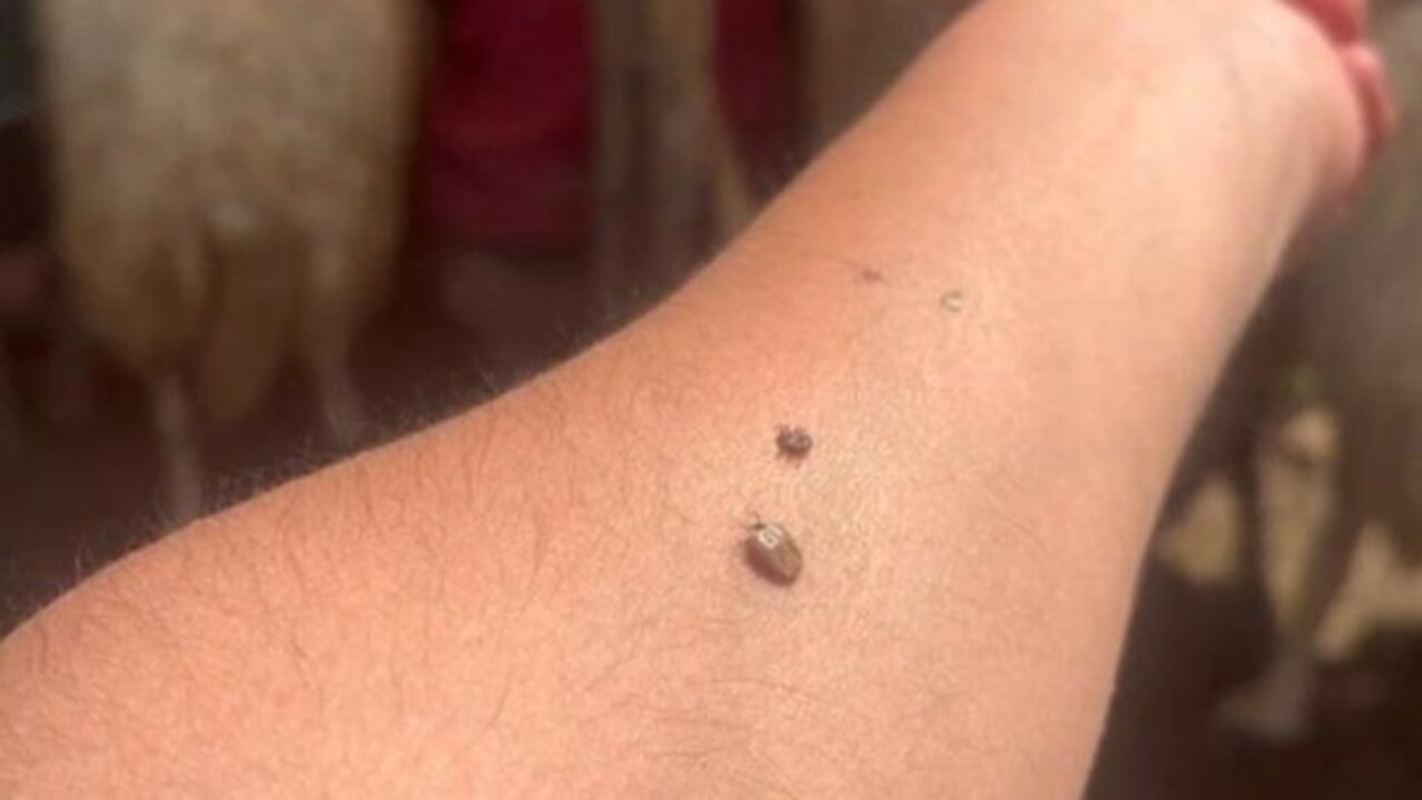 Yaz ve İlkbahar mevsimlerinde dikkat! Kenelere karşı uzmanından uyarı