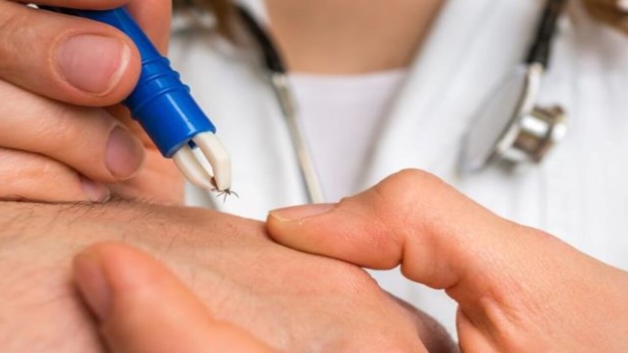 Foto - Yaz ve İlkbahar mevsimlerinde dikkat! Kenelere karşı uzmanından uyarı