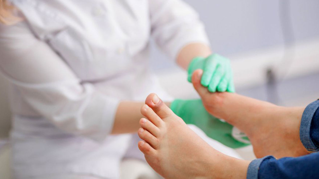 Foto - Yazın görmezden gelinen tehlike! Diyabet hastalarında ayak kaybına götüren risk